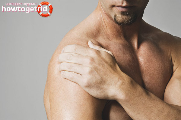 Симптомы артрита плечевого сустава